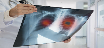 Online live CEUs for respiratory therapists:ARDS: Advanced Ventilation and Critical Care Strategies Part 2